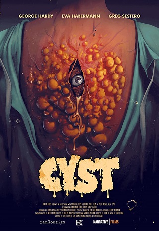 Cyst (2020) บรรยายไทยแปล